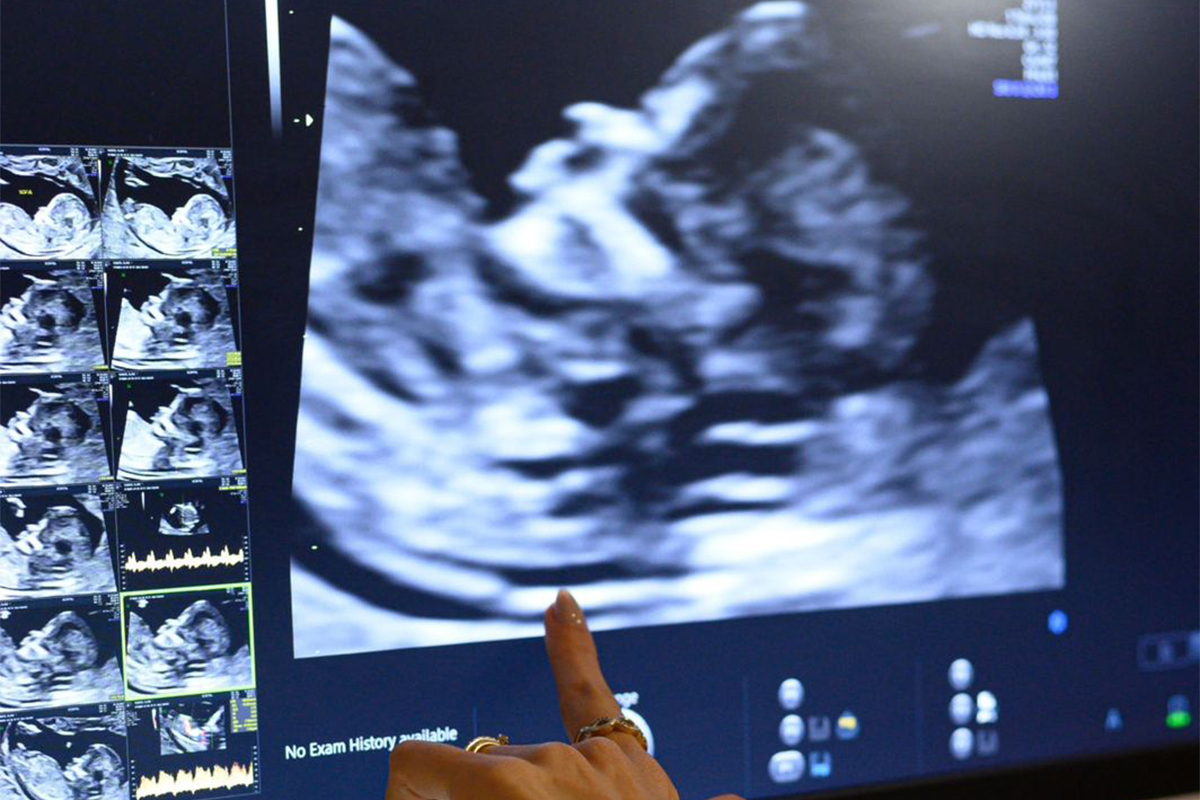 Ultrassom morfológico em Blumenau - Essenza Ultrassonografia